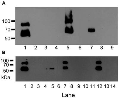 Slipped-strand mispairing within a polycytidine tract in transcriptional regulator mga leads to M protein phase variation and Mga length polymorphism in Group A Streptococcus